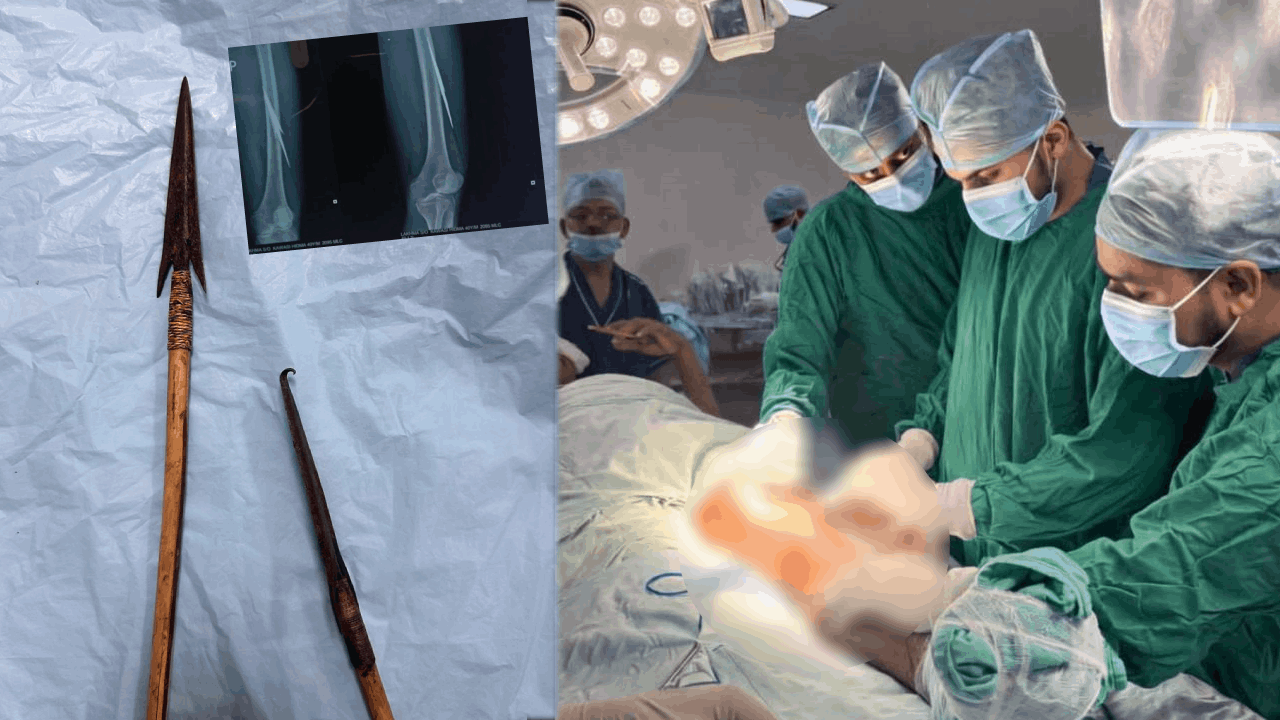 मेकाज में मरीज को जीवनदान