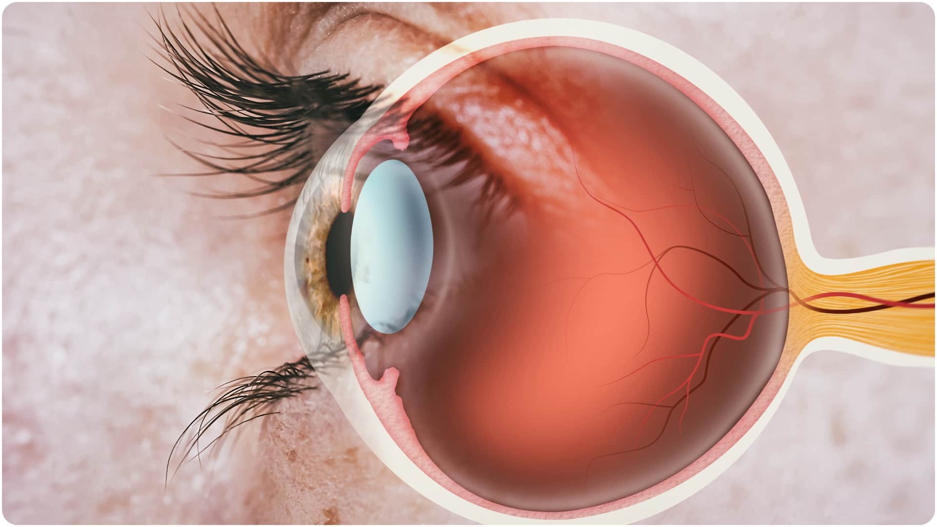 आंखों की समस्याओं के बारे में जानिए