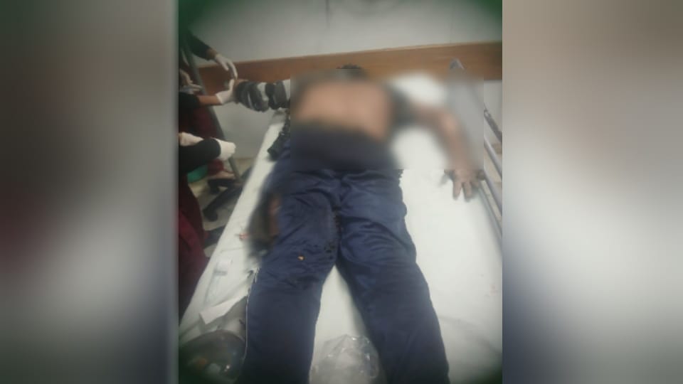 Meerut: Lineman Severely Burnt at Power Substation in Partapur Udyogpuram, Condition Critical