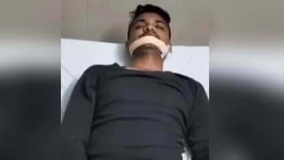 Meerut: A Chinese manja came waving and cut the inspector's face, 18 stitches were required