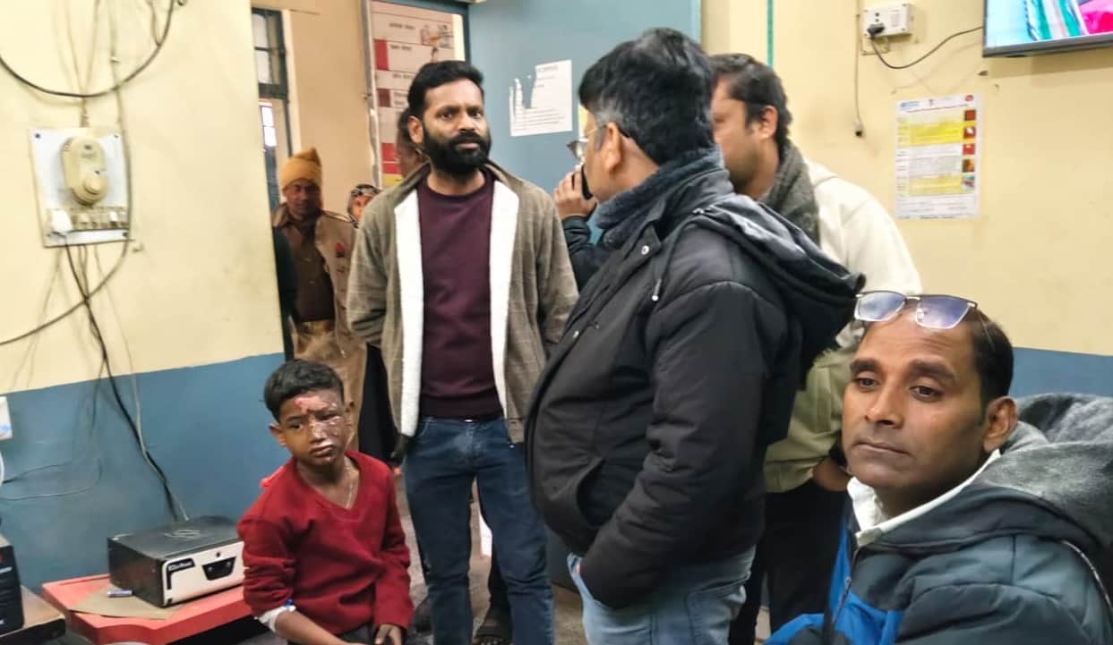कबाड़ बीनने गए बच्चे पर फेंका तेजाब