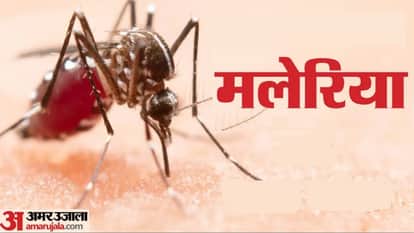 Kanpur GSVM New drug will curb stubborn malaria DCGI approves new drug combination