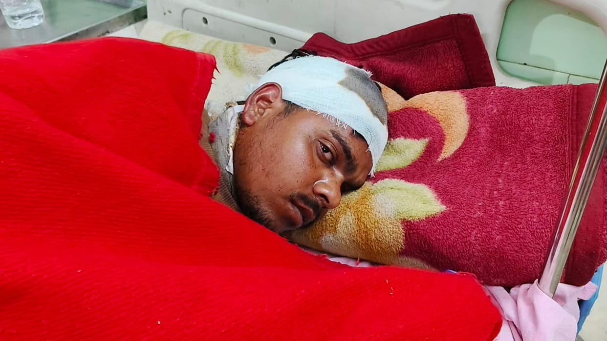 son tried to stop his father from drinking alcohol the father attacked him with an axe in Bareilly