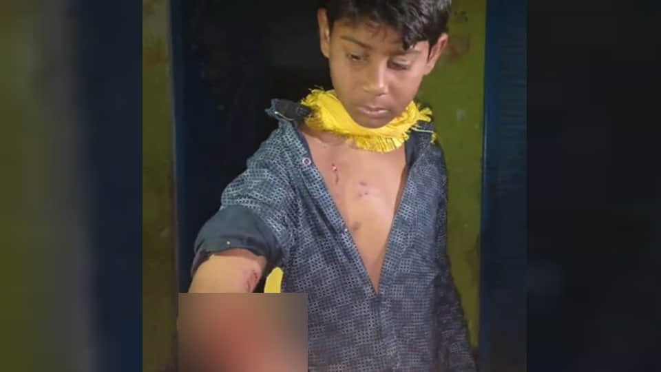 घायल बालक