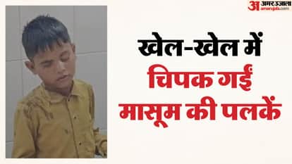 Banswara News: Child’s eyelids stick together after adhesive falls into eyes during play at school