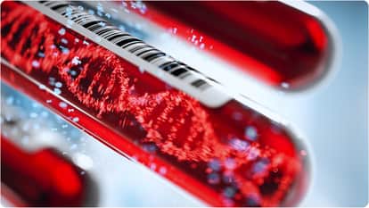 mild toothache turned into fast-growing blood cancer know What is blood cancer and its symotoms