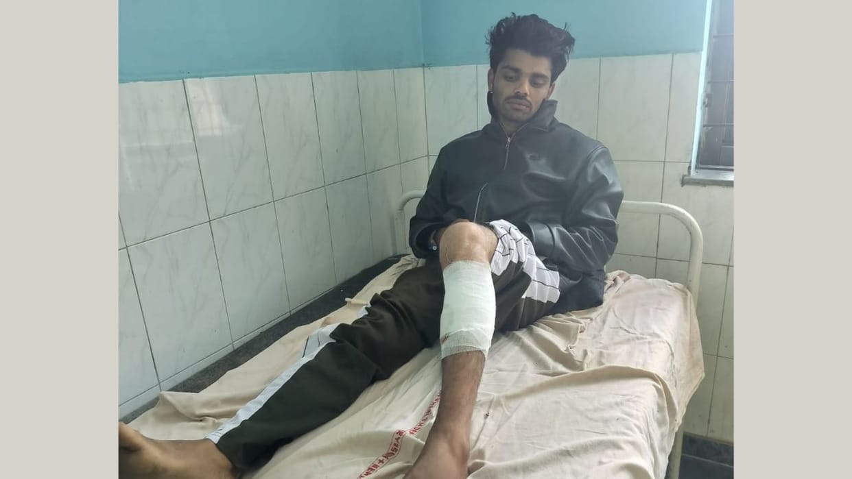 Criminal Rashid injured after being shot in leg in police encounter in Gurugram