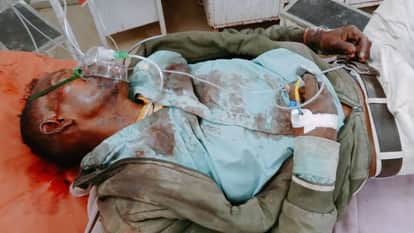 अस्पताल में भर्ती घायल युवक।