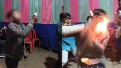 boy face burnt during dangerous reel fire stunt watch horrible viral video