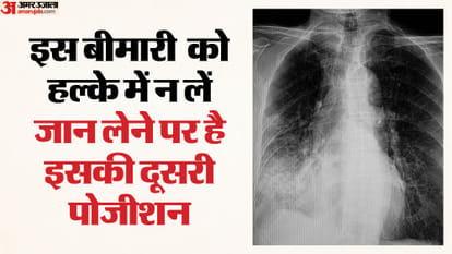 बच्चों को इस बीमारी से सबसे अधिक खतरा