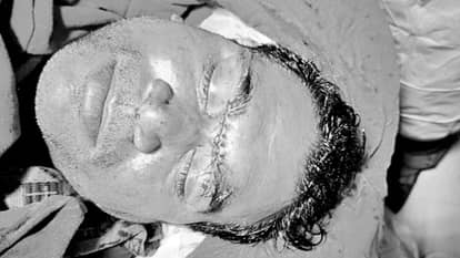 Chinese kite string causes gruesome injuries Healthcare worker  eyebrow and eyelids cut requiring 16 stitches