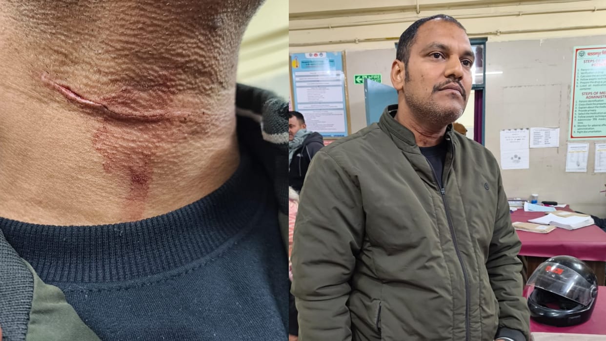 Lucknow: Another youth injured by Chinese manjha in Lucknow, escaped neck slitting