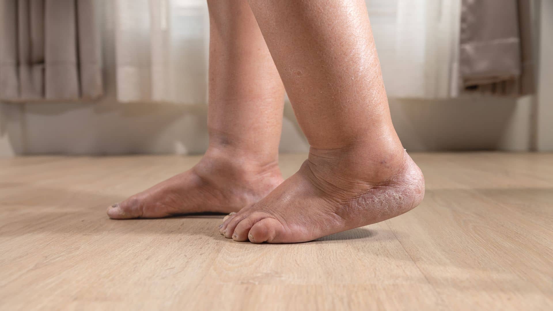 Difference Between Lumps, Swelling, and Pimples: When to See a Doctor