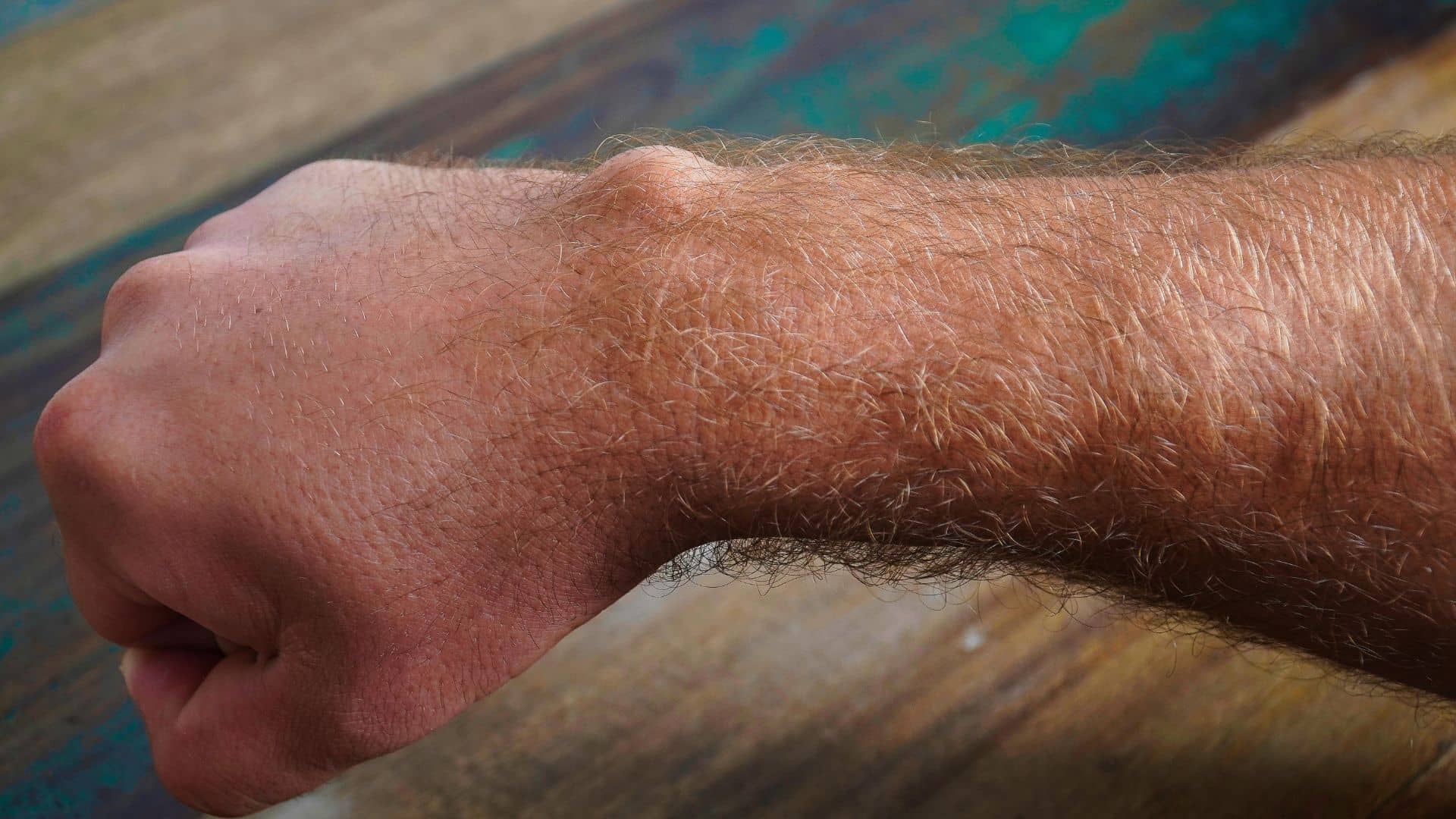 Difference Between Lumps, Swelling, and Pimples: When to See a Doctor