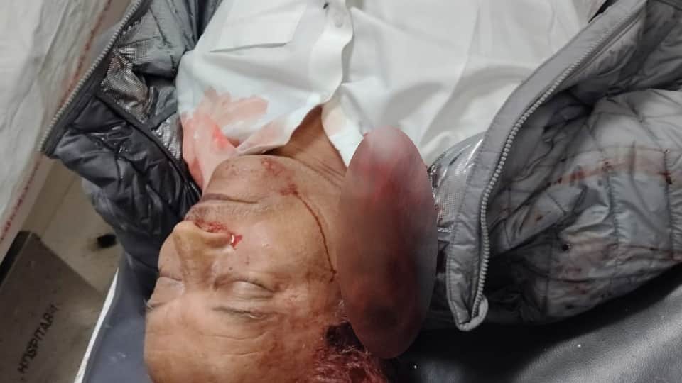 पीजीआई रोहतक में मृतक का शव।