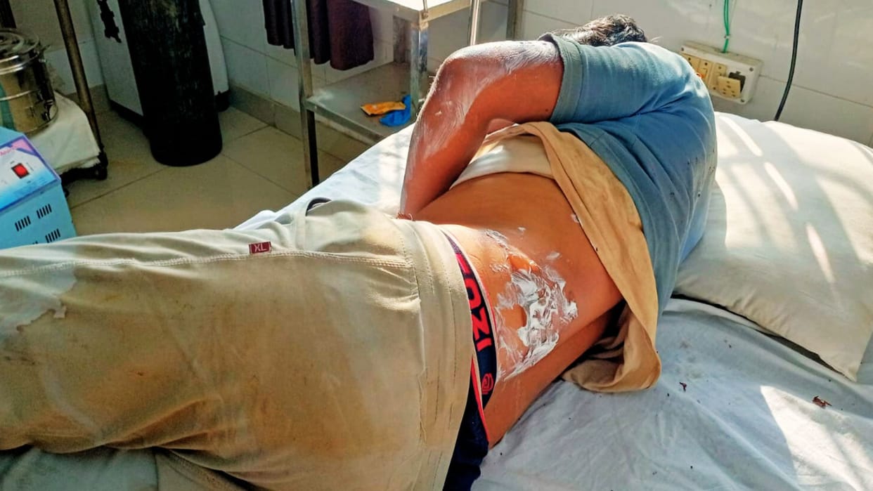 Varanasi News dispute shopkeeper son threw boiling tea injuring young man six people beat him with sticks