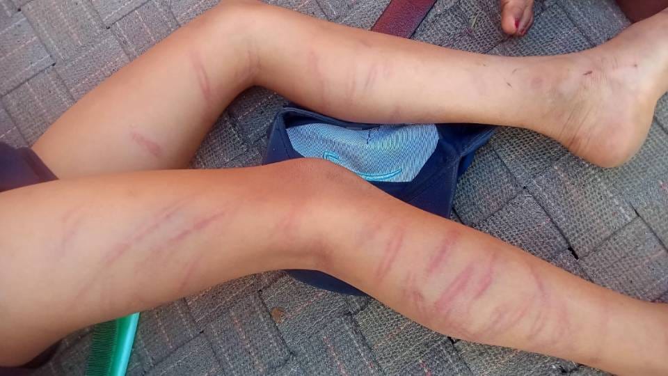 teacher thrashed 105 times sticks class 2 student in private school for not completing his homework in Gonda