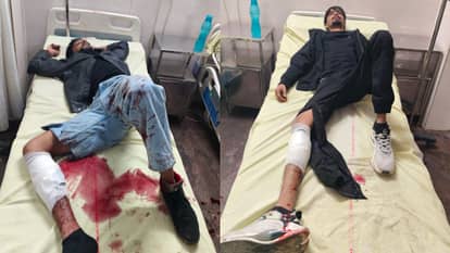 Encounter in Fatehabad: Two accused arrested in cash robbery and firing incident involving a dry fruit trader