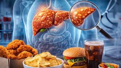 CSIR and AIIMS Delhi research claims liver fibrosis in more than four percent of patients