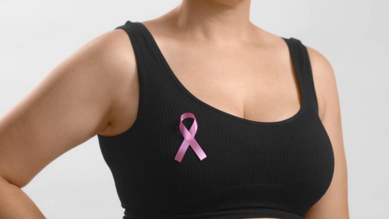Not breastfeeding and late marriage increase the risk of breast cancer