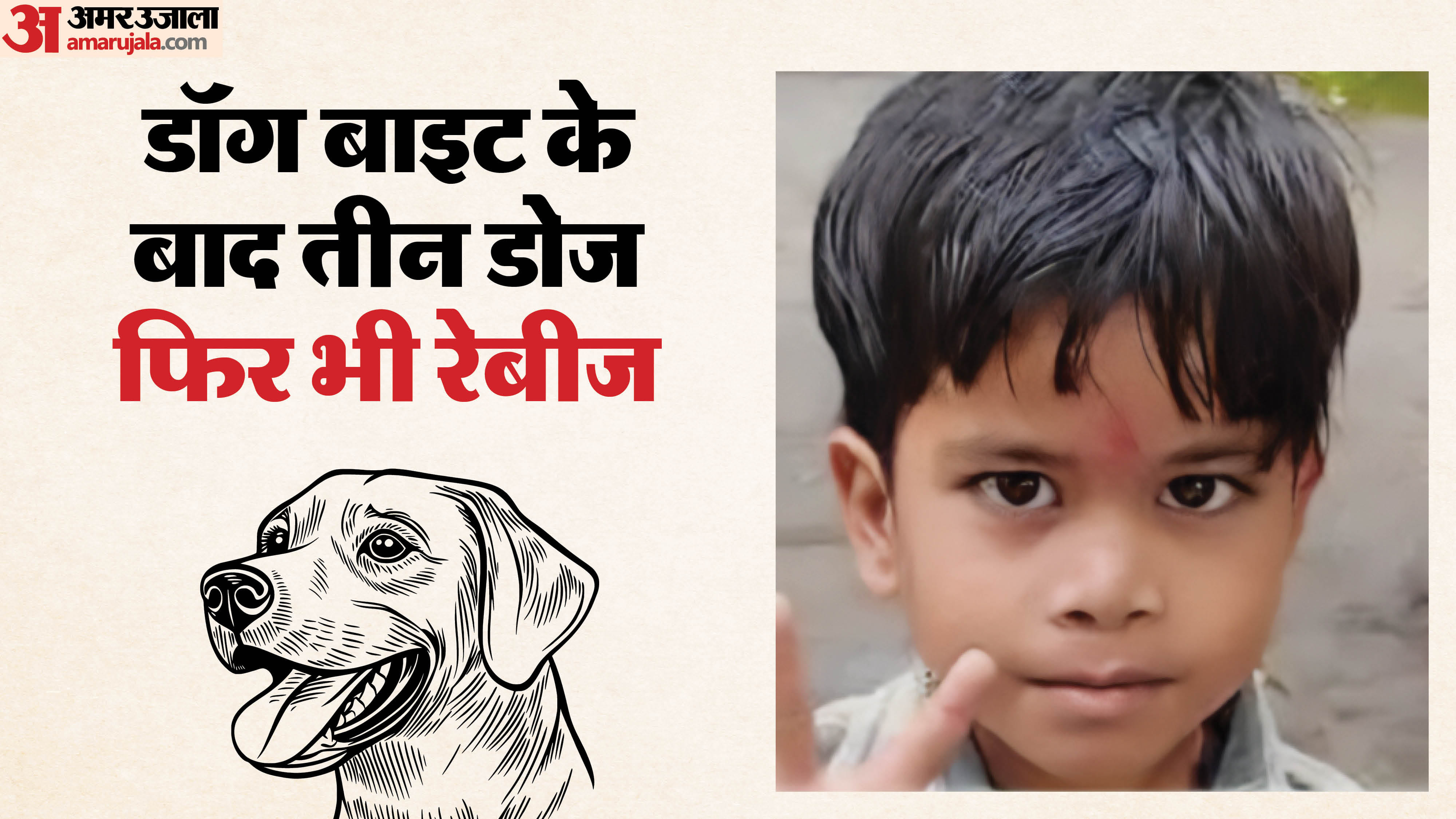 इसी बच्चे को कुत्ते ने काटा