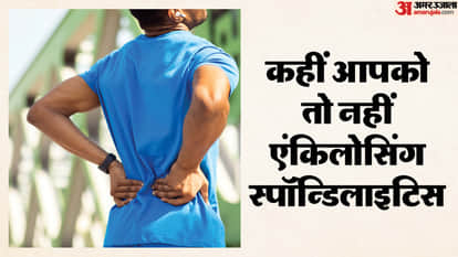 Do not ignore back pain at age of 25 it can lead to serious illness