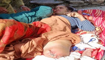 Referred after five days of incomplete treatment at the district hospital in pithoragarh