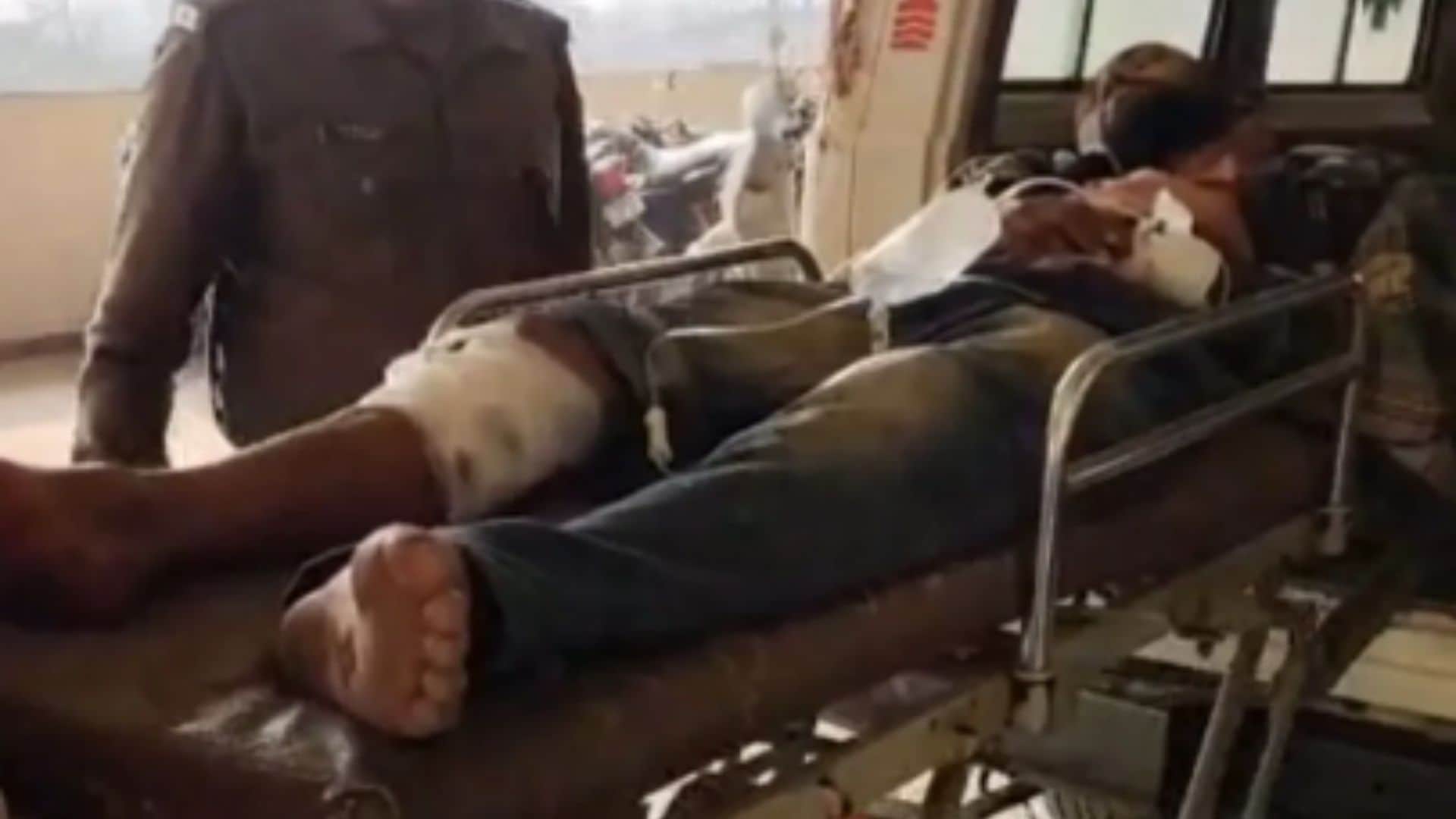 एनकाउंटर में घायल बदमाश