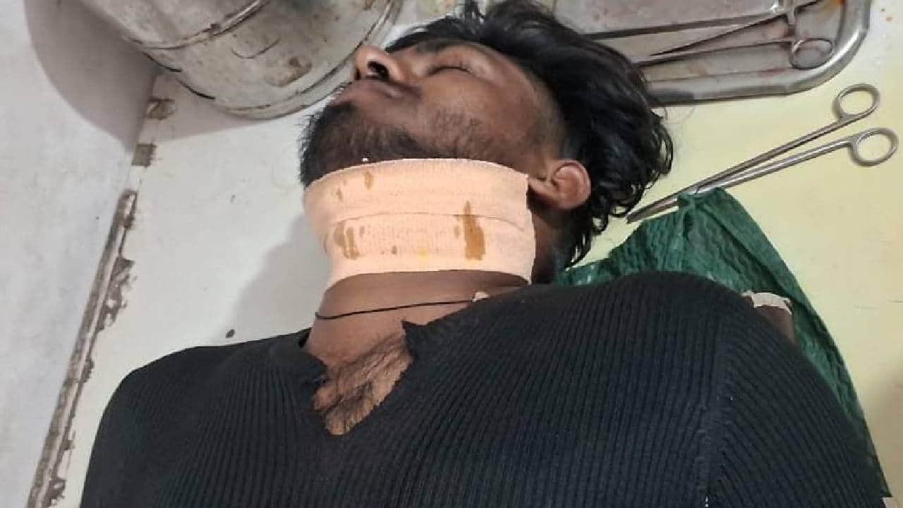 घायल युवक का इलाज जारी