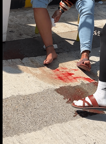 Jaipur Airport: Dog Bites Woman Passenger at Jaipur International Airport Terminal-2, Raises Security Concerns