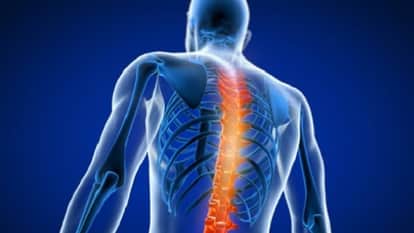 UP: Spinal TB paralyzed legs during pregnancy, rare case reported at KGMU; learn why