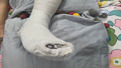 Lift falls from 13th floor to 8th floor Elderly woman suffers four broken legs learn cause of accident in noid