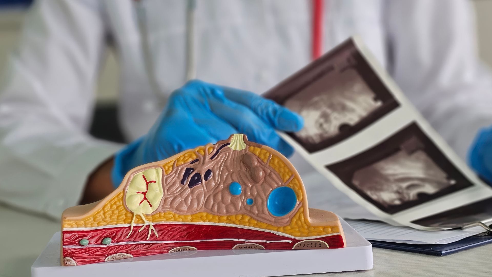 Women who postpone having children face significantly higher risk of breast cancer