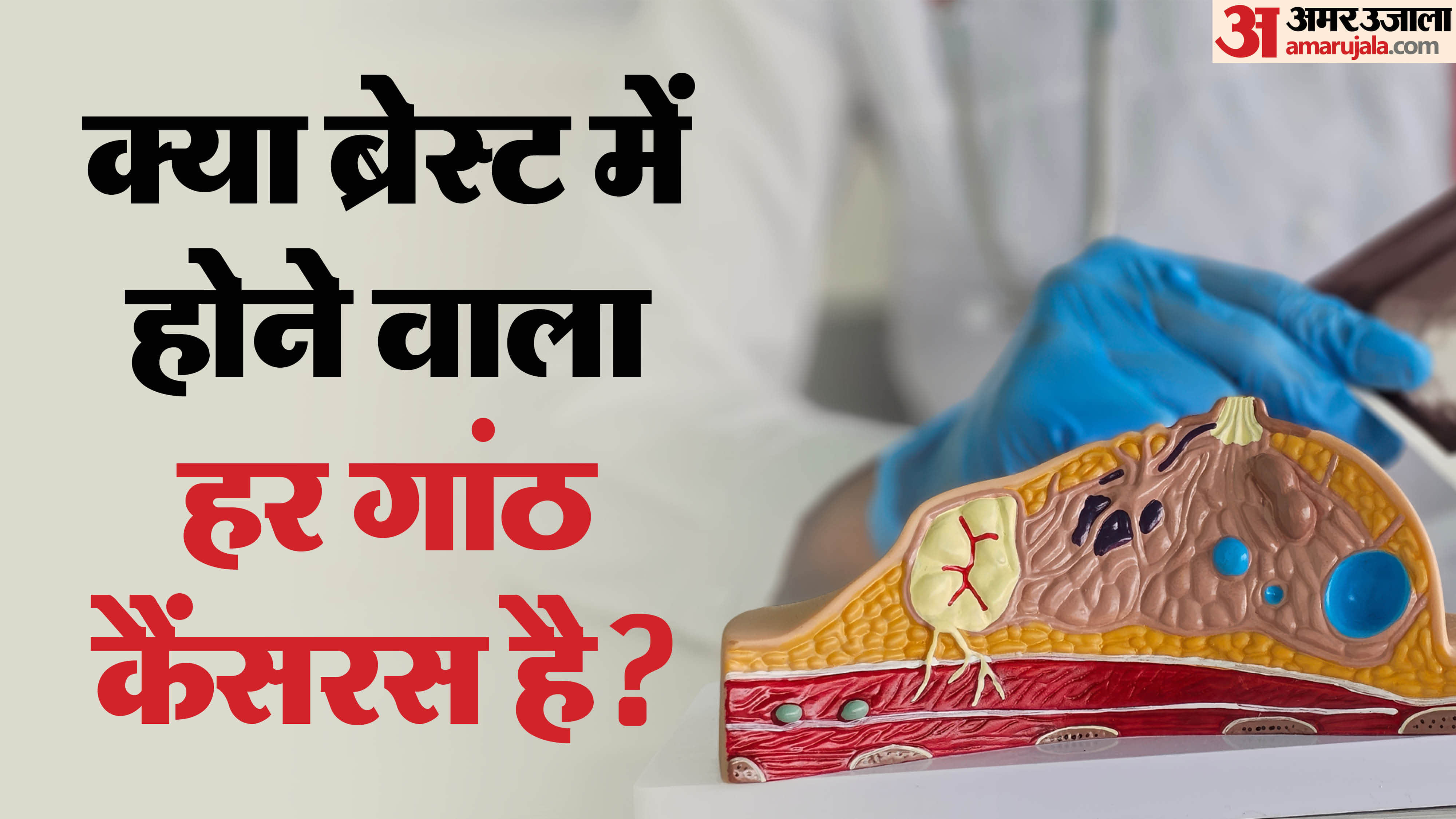 Are All Breast Lumps Cancerous? Study Shows 80% Lumps are Non-Cancerous: Benign vs Malignant Signs