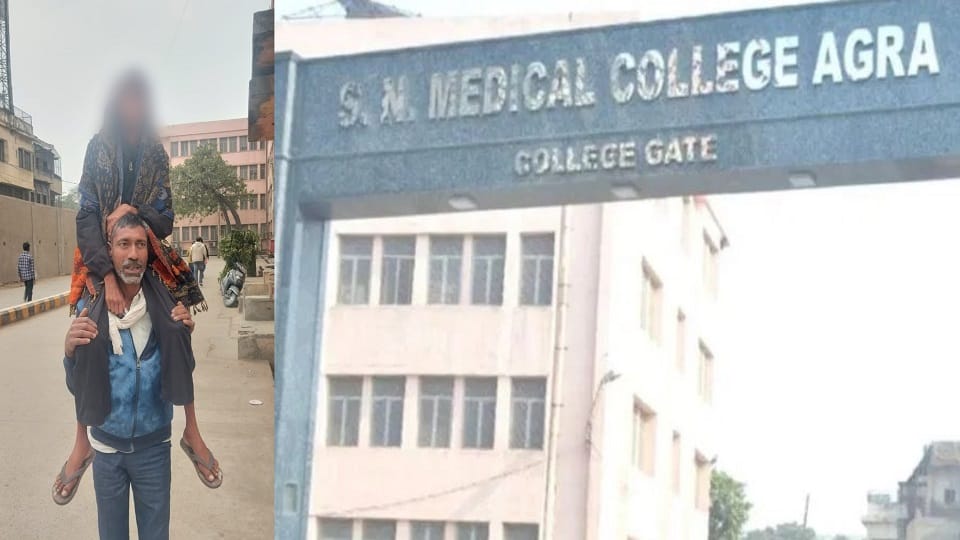 Father forced to carry daughter on his shoulders to SN Medical College due to unavailability of stature