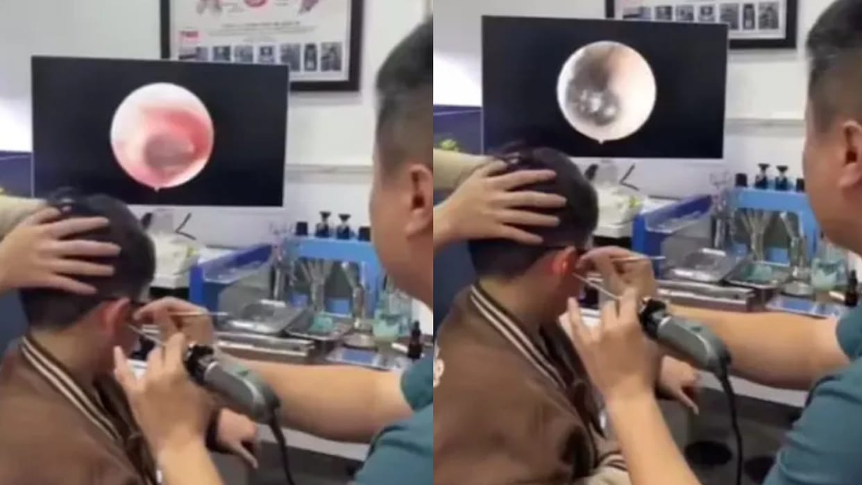 screw was found in the ear of a child viral videos in hindi