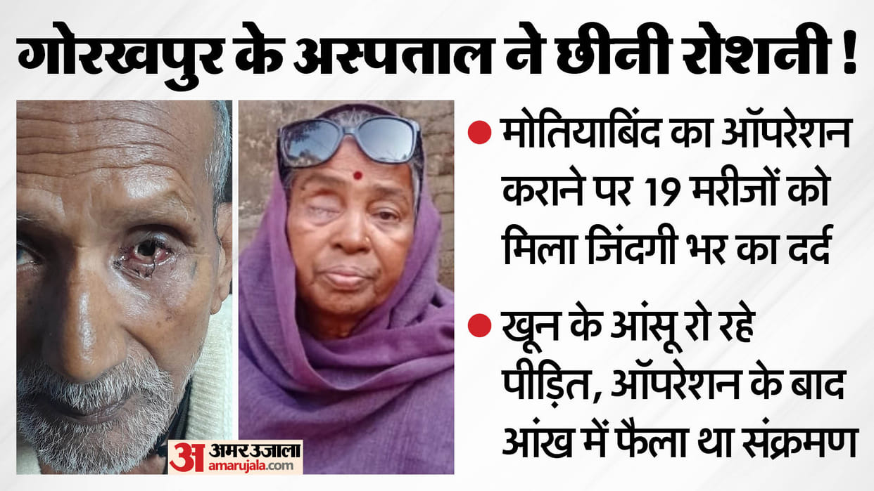 Gorakhpur Hospital Negligence Cataract Surgeries Lead to Severe Infection Patient Lose Eyes