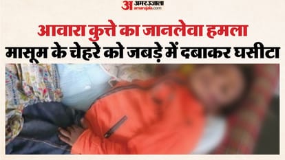 पांच साल के मासूम पर आवारा कुत्ते ने किया जानलेवा हमला