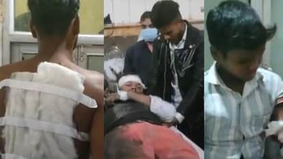 Sitapur: Late-night firing at Tilak ceremony; groom and teenager hit by pellets