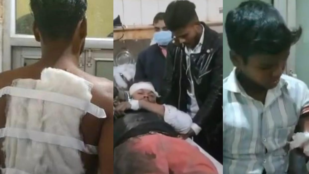 Sitapur: Late-night firing at Tilak ceremony; groom and teenager hit by pellets