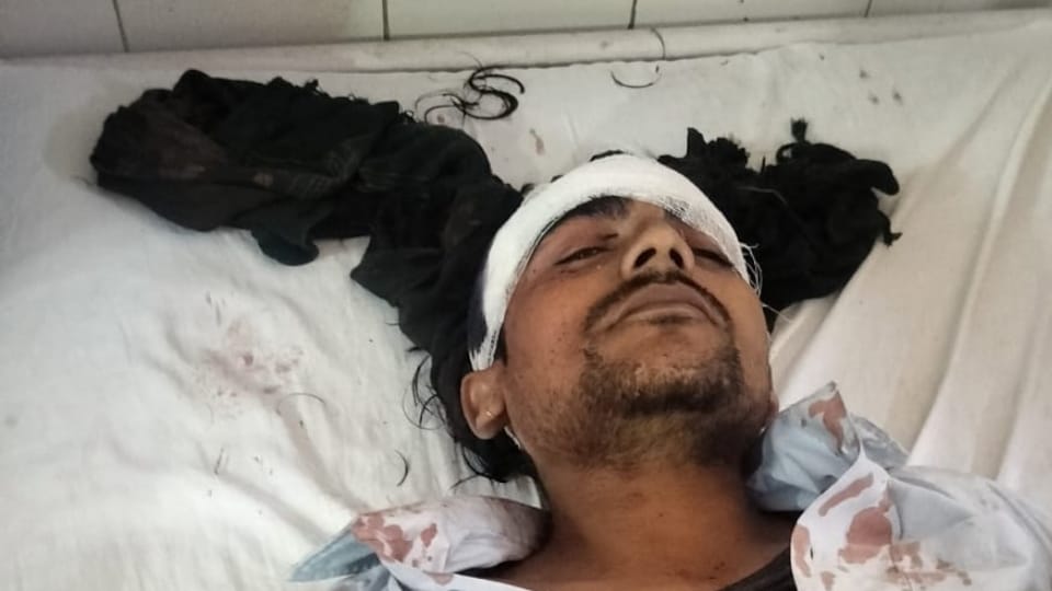 Lawyer injured in Hapur due to rivalry, referred to Meerut