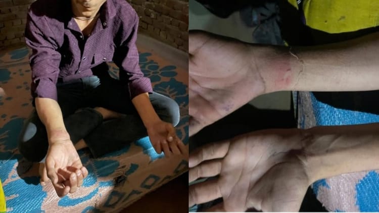खाकी का खौफनाक रूप: 10वीं के छात्र को दी थर्ड डिग्री, पीट-पीटकर तोड़ी कलाई; नहीं दे पाएगा बोर्ड परीक्षा