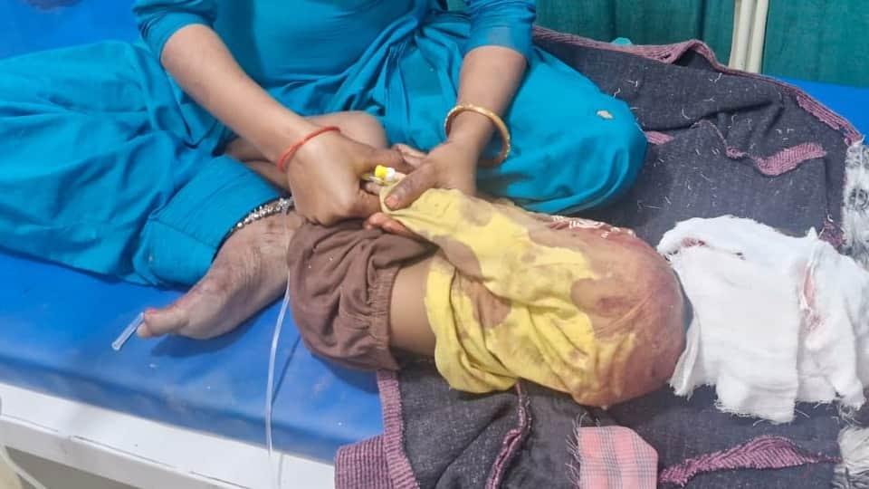 अस्पताल में भर्ती बच्ची।