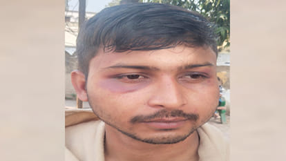 Kanpur: sub-inspector and a constable slapped an airman, rupturing his eardrum