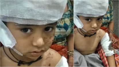 Bikaner News: Four-Year-Old Man Mashed by Dogs on First Day of School, Arrived at Hospital in Bloody Condition
