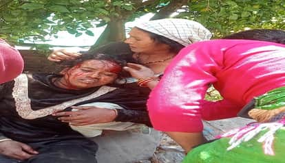 A bear attacked her, and a woman struggled to save her life in pithoragarh