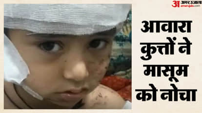 Rajasthan: Dogs attack 4 year old on first day of school scalp torn off in bikaner news in hindi