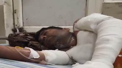 Woman Allegedly Sets Auto-Driver Husband on Fire in Agra Victim Critical