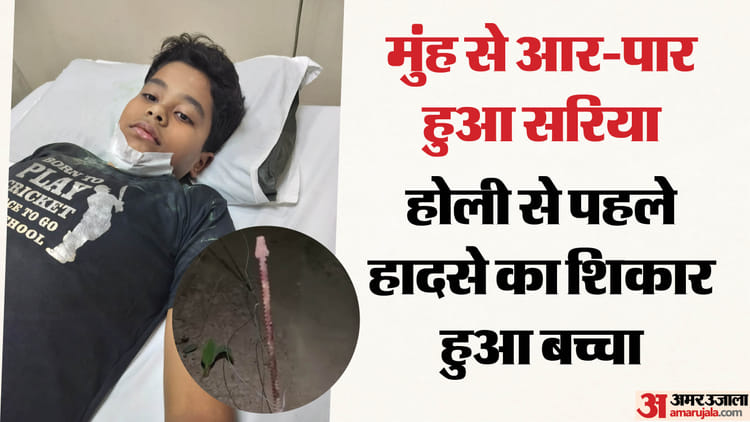 बच्चे के मुंह से आर-पार हुआ सरिया: दोस्तों संग होली खेल रहा था, बिल्डर के खिलाफ सोसायटी में आक्रोश; Video