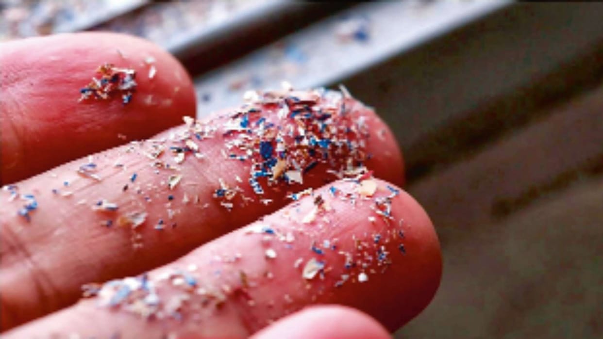 High levels of plastic in prostate cancer tissue increase risk Are microplastics increasing the risk